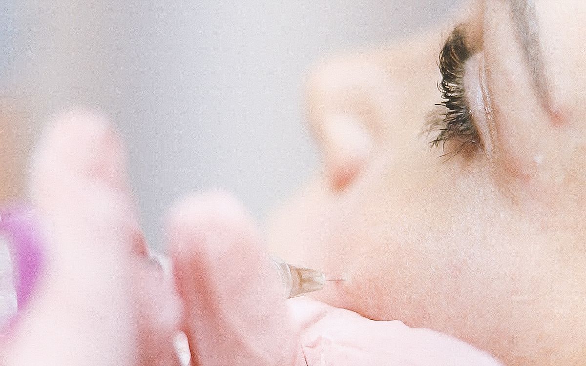 Sessão de intradermoterapia