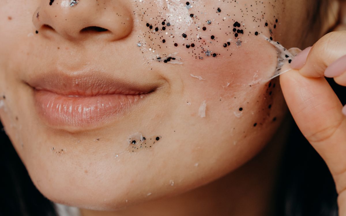 Peeling químico em andamento