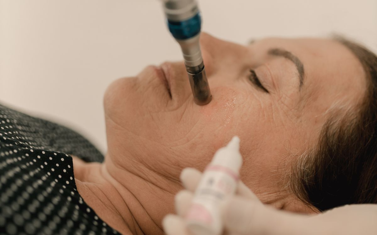 Tratamento com jato de plasma